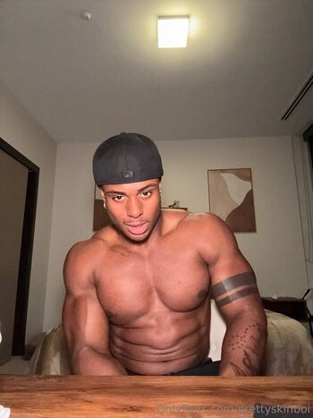 prettyskinboi
